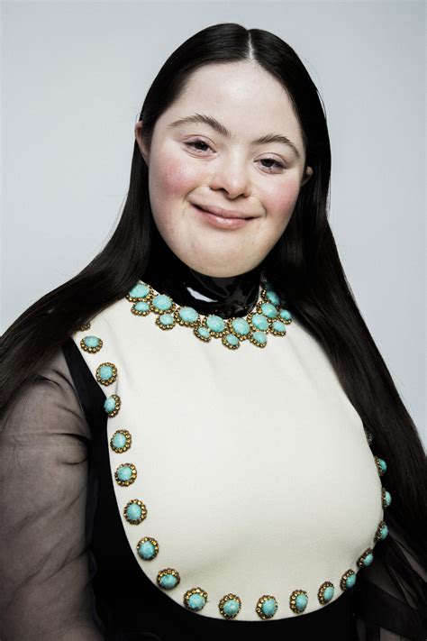 down syndrome model Gucci